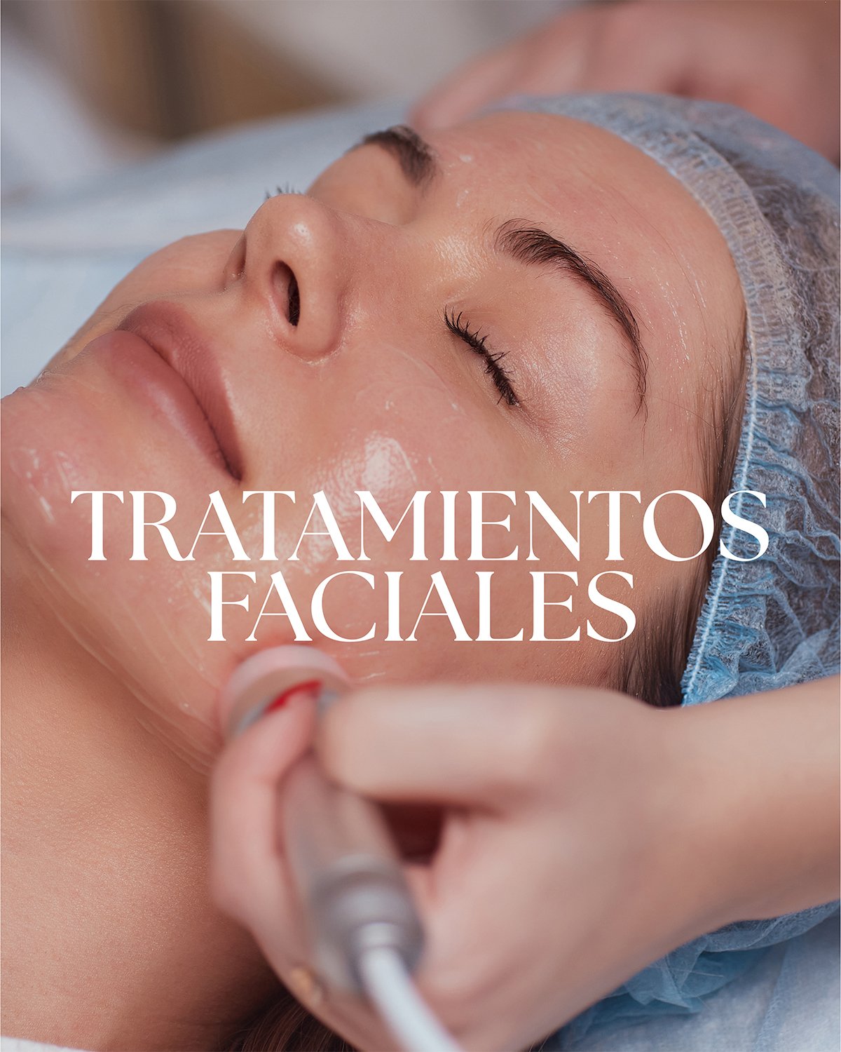 Rejuvenecimiento Facial